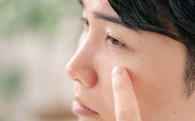 眼瞼下垂